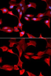Anti-GCLM antibody used in Immunocytochemistry/ Immunofluorescence (ICC/IF). GTX32622