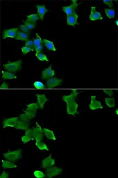 Anti-Glutamine synthetase antibody used in Immunocytochemistry/ Immunofluorescence (ICC/IF). GTX32627