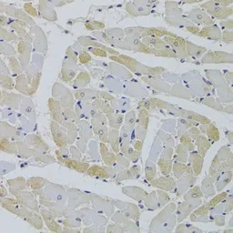 Anti-GPD1 antibody used in IHC (Paraffin sections) (IHC-P). GTX32630