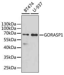 Anti-GRASP65 antibody used in Western Blot (WB). GTX32631