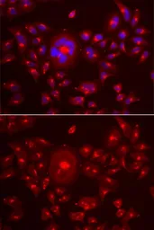 Anti-GRASP65 antibody used in Immunocytochemistry/ Immunofluorescence (ICC/IF). GTX32631