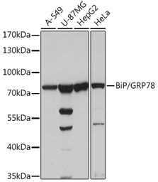 Anti-Grp78 antibody used in Western Blot (WB). GTX32636
