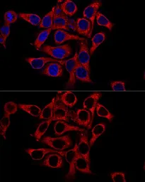 Anti-Grp78 antibody used in Immunocytochemistry/ Immunofluorescence (ICC/IF). GTX32636