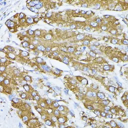 Anti-Grp78 antibody used in IHC (Paraffin sections) (IHC-P). GTX32636