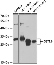 Anti-GSTM4 antibody used in Western Blot (WB). GTX32637