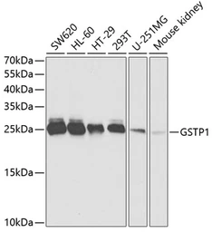 Anti-GSTP1 antibody used in Western Blot (WB). GTX32639