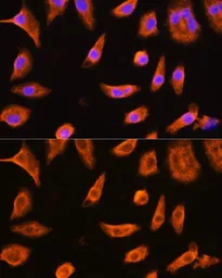 Anti-GSTP1 antibody used in Immunocytochemistry/ Immunofluorescence (ICC/IF). GTX32639