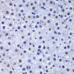 Anti-GSTP1 antibody used in IHC (Paraffin sections) (IHC-P). GTX32639