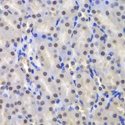 Anti-GSTP1 antibody used in IHC (Paraffin sections) (IHC-P). GTX32639