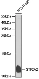 Anti-GTF2A2 antibody used in Western Blot (WB). GTX32640