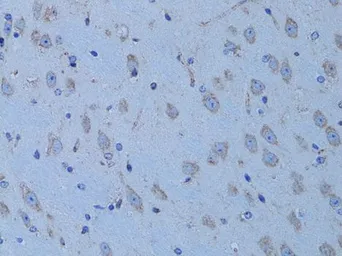 Anti-HADH antibody used in IHC (Paraffin sections) (IHC-P). GTX32641