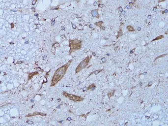 Anti-HADH antibody used in IHC (Paraffin sections) (IHC-P). GTX32641