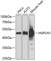 Anti-HAPLN1 antibody used in Western Blot (WB). GTX32643