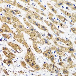 Anti-HAPLN1 antibody used in IHC (Paraffin sections) (IHC-P). GTX32643