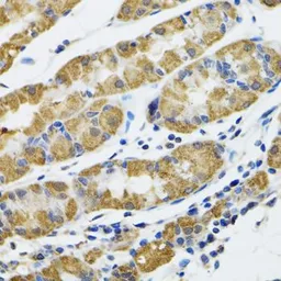 Anti-HAPLN1 antibody used in IHC (Paraffin sections) (IHC-P). GTX32643