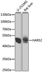Anti-HARS2 antibody used in Western Blot (WB). GTX32644