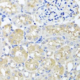Anti-HARS2 antibody used in IHC (Paraffin sections) (IHC-P). GTX32644