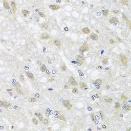 Anti-HARS2 antibody used in IHC (Paraffin sections) (IHC-P). GTX32644