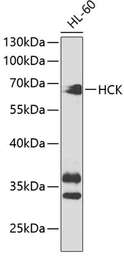 Anti-HCK antibody used in Western Blot (WB). GTX32645