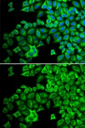 Anti-HCK antibody used in Immunocytochemistry/ Immunofluorescence (ICC/IF). GTX32645