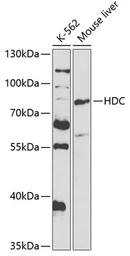 Anti-HDC antibody used in Western Blot (WB). GTX32647