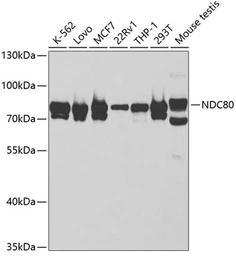 Anti-Hec1 antibody used in Western Blot (WB). GTX32648