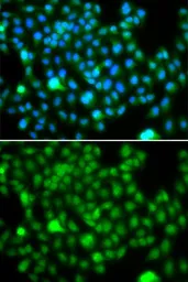 Anti-HEMK2 antibody used in Immunocytochemistry/ Immunofluorescence (ICC/IF). GTX32649