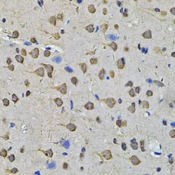 Anti-HEMK2 antibody used in IHC (Paraffin sections) (IHC-P). GTX32649