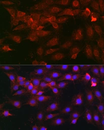 Anti-Heparanase 1 antibody used in Immunocytochemistry/ Immunofluorescence (ICC/IF). GTX32650
