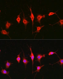 Anti-Heparanase 1 antibody used in Immunocytochemistry/ Immunofluorescence (ICC/IF). GTX32650