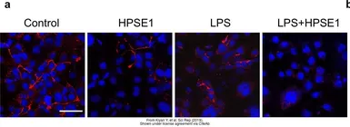 Anti-Heparanase 1 antibody used in Immunocytochemistry/ Immunofluorescence (ICC/IF). GTX32650