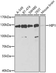 Anti-HIP1 antibody used in Western Blot (WB). GTX32653