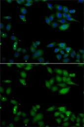Anti-HIP1 antibody used in Immunocytochemistry/ Immunofluorescence (ICC/IF). GTX32653
