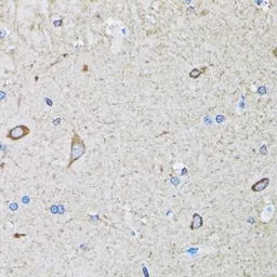 Anti-HIP1 antibody used in IHC (Paraffin sections) (IHC-P). GTX32653