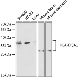 Anti-HLA-DQA1 antibody used in Western Blot (WB). GTX32654