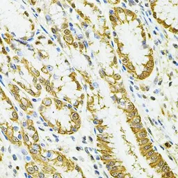 Anti-HLA-DQA1 antibody used in IHC (Paraffin sections) (IHC-P). GTX32654