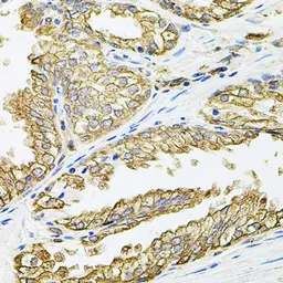 Anti-HLA-DQA1 antibody used in IHC (Paraffin sections) (IHC-P). GTX32654