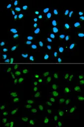 Anti-hnRNP A2B1 antibody used in Immunocytochemistry/ Immunofluorescence (ICC/IF). GTX32657
