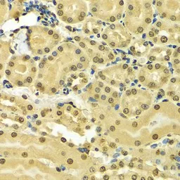 Anti-hnRNP A2B1 antibody used in IHC (Paraffin sections) (IHC-P). GTX32657
