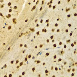 Anti-hnRNP A2B1 antibody used in IHC (Paraffin sections) (IHC-P). GTX32657