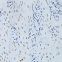 Anti-hnRNP K antibody used in IHC (Paraffin sections) (IHC-P). GTX32658