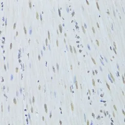 Anti-hnRNP K antibody used in IHC (Paraffin sections) (IHC-P). GTX32658