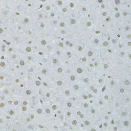 Anti-hnRNP K antibody used in IHC (Paraffin sections) (IHC-P). GTX32658
