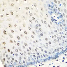 Anti-hnRNP A0 antibody used in IHC (Paraffin sections) (IHC-P). GTX32659