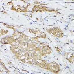 Anti-HSC70 antibody used in Immunocytochemistry/ Immunofluorescence (ICC/IF). GTX32660
