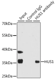 Anti-HUS1 antibody used in Immunoprecipitation (IP). GTX32662