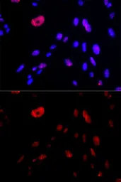Anti-HUS1 antibody used in Immunocytochemistry/ Immunofluorescence (ICC/IF). GTX32662