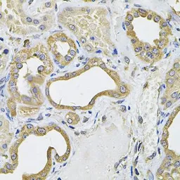 Anti-ICOS Ligand antibody used in IHC (Paraffin sections) (IHC-P). GTX32664