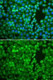 Anti-IDE antibody used in Immunocytochemistry/ Immunofluorescence (ICC/IF). GTX32665