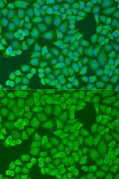Anti-IFI44 antibody used in Immunocytochemistry/ Immunofluorescence (ICC/IF). GTX32667